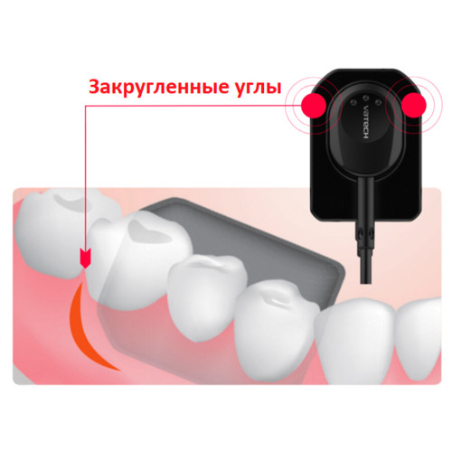 Vatech EzSensor Classic цифровой интраоральный радиовизиограф