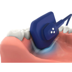 Vatech EzSensor Soft цифровой интраоральный радиовизиограф 1.5