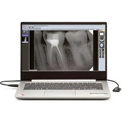 New Life Radiology Mercury DIGISENS цифровой интраоральный радиовизиограф, 20 микрон