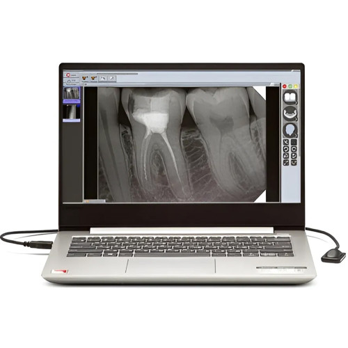 New Life Radiology Mercury DIGISENS цифровой интраоральный радиовизиограф, 20 микрон
