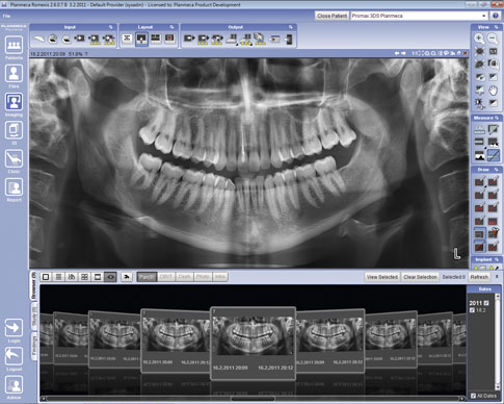 Planmeca ProMax 3D
