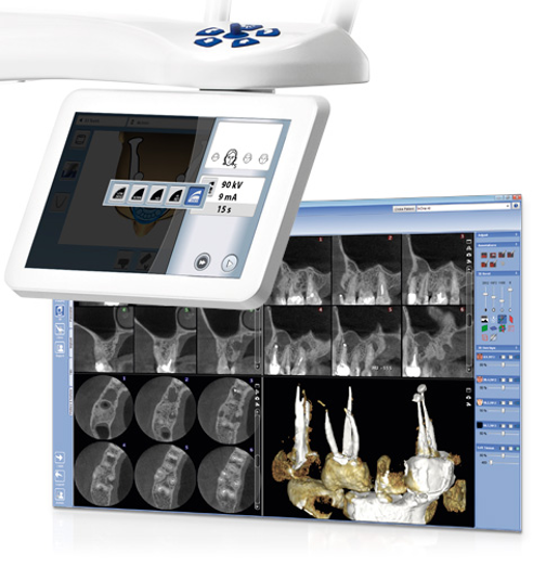 Planmeca ProMax 3D