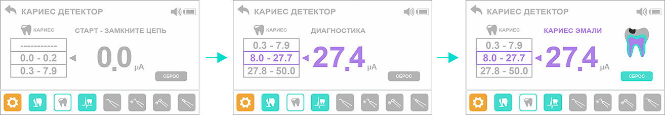 Geosoft Estus Multi Plus апекслокатор с цветным сенсорным дисплеем и функцией блока управления